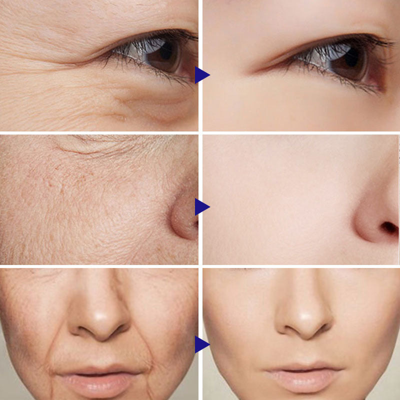 Siero alla Vitamina C – Glow Booster per Pelle Luminosa | VitaZen